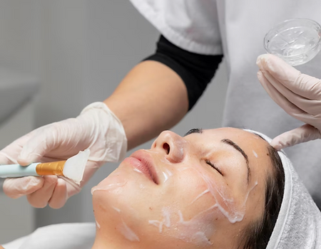 A Woman taking Chemical Peels | What Are Chemical Peels, Types, Risks, and Recovery | Just Glam Aesthetics in Astoria, NY