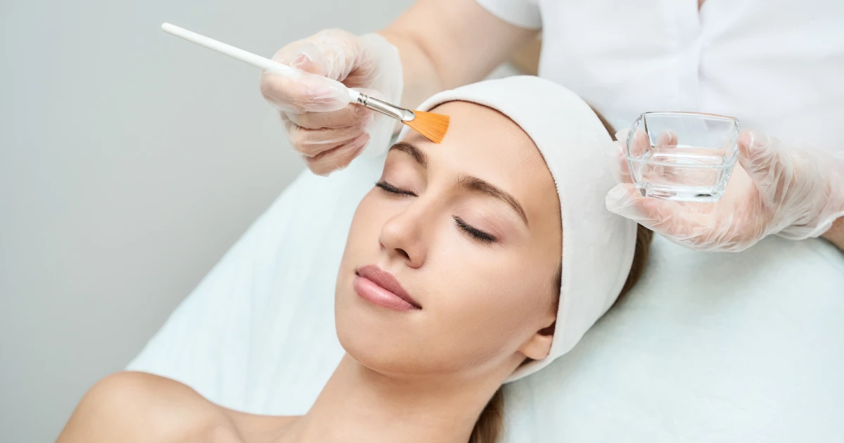 Microneedling & Chemical Peel in Astoria, NY